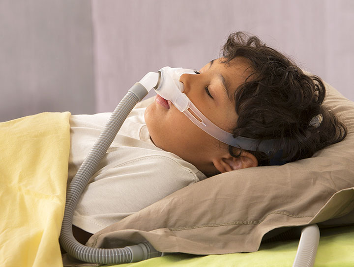Obstructive Sleep Apnea