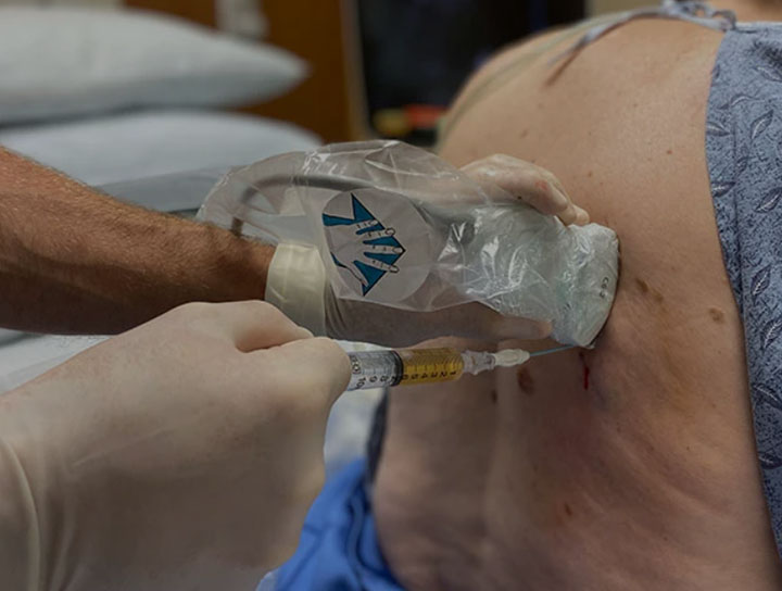 Thoracentesis